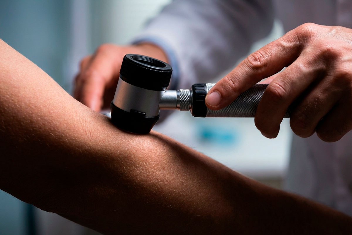 Бесплатный скрининг на рак кожи в Германии хотят отменить. Фото: ausnews.de